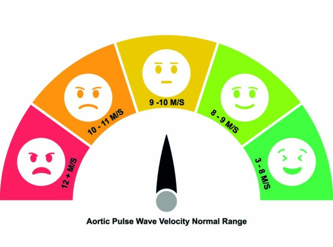 pulse wave velosity is a predictor of arterial disease
